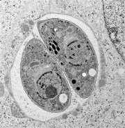 トキソプラズマ原虫の電子顕微鏡写真