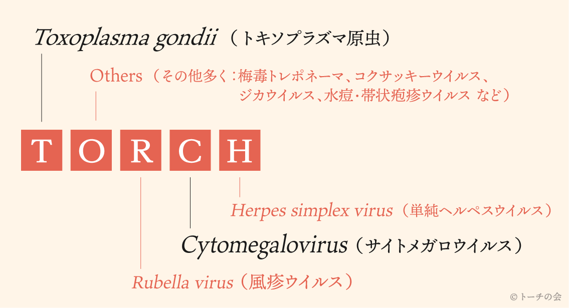 トーチ症候群　Toxoplasma gondii（トキソプラズマ原虫）、Othersジカウイルス、水痘・帯状疱疹ウイルス など）（その他多く：梅毒トレポネーマ、コクサッキーウイルス、Rubella virus（風疹ウイルス）、Cytomegalovirus（サイトメガロウイルス）、Herpes simplex virus （単純ヘルペスウイルス）